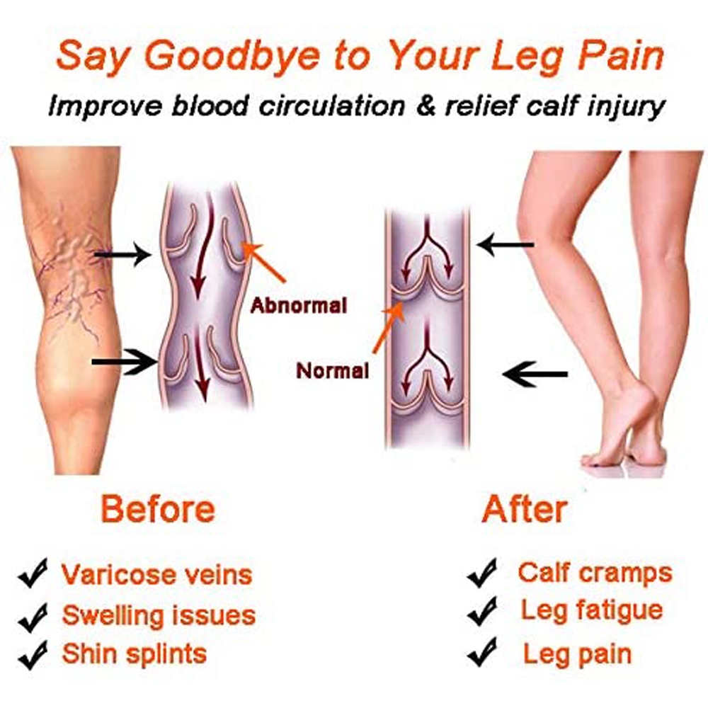 1 คู่ลูกวัวการบีบอัดขาถุงเท้าก - Compression Sleeve Calf บทวิจารณ์และราคา